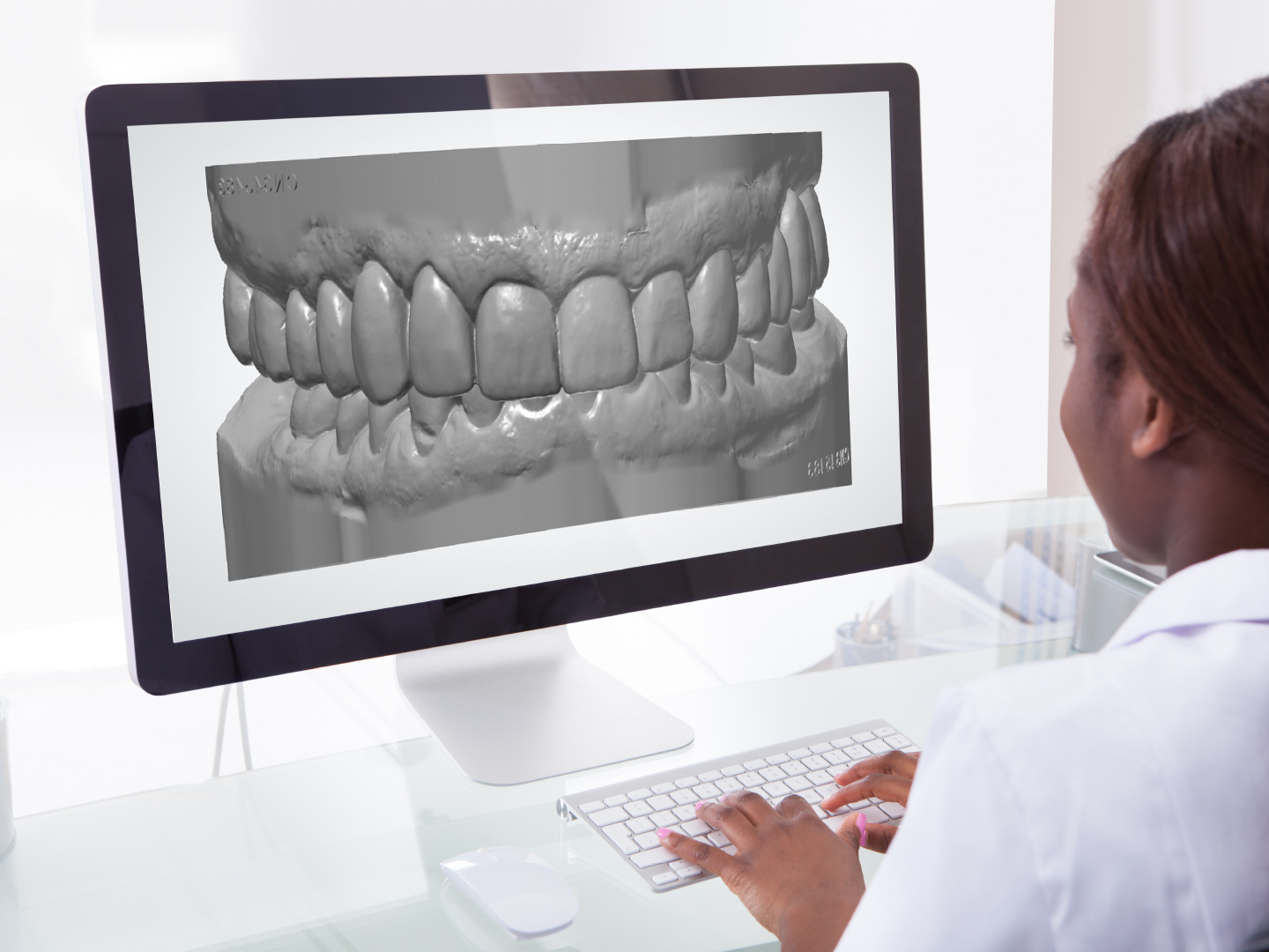 DenMat Dental Lab - Digital Impression Systems